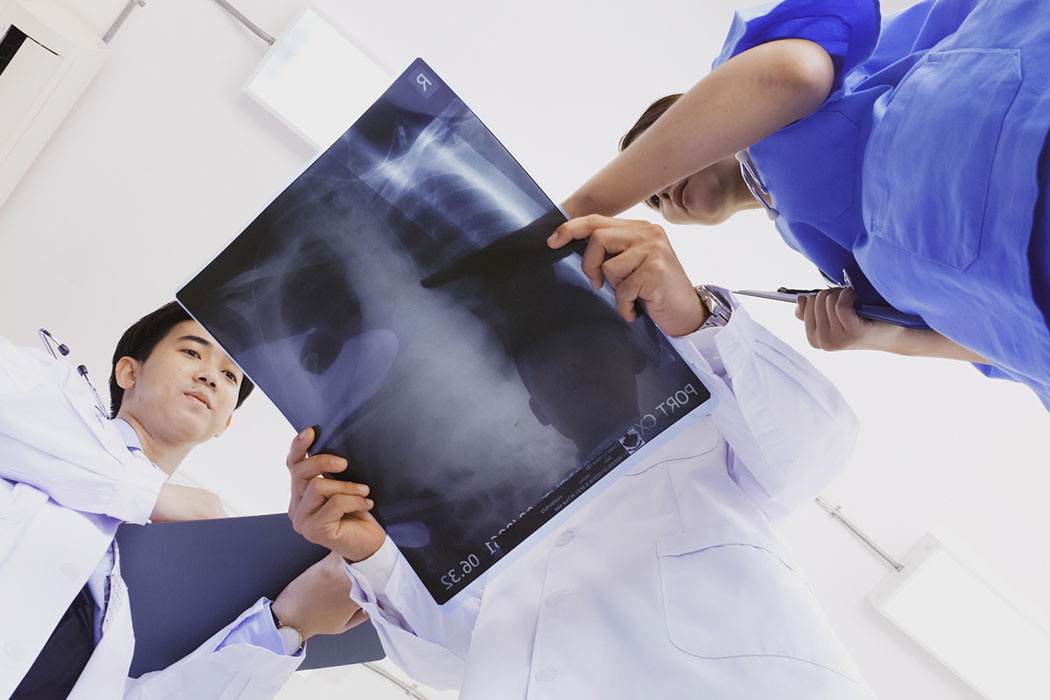 Understanding Radiology Errors and How to Fight for Compensation