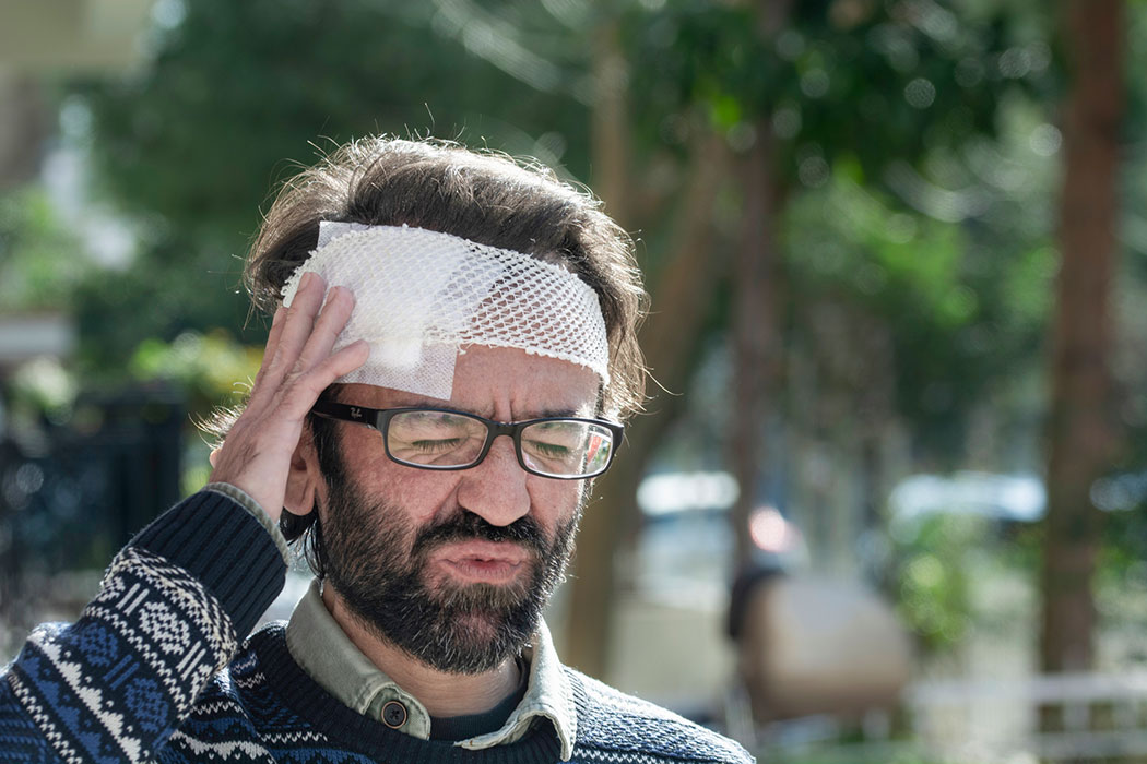 What Damages Can You Recover in A Michigan Head Injury Claim?
